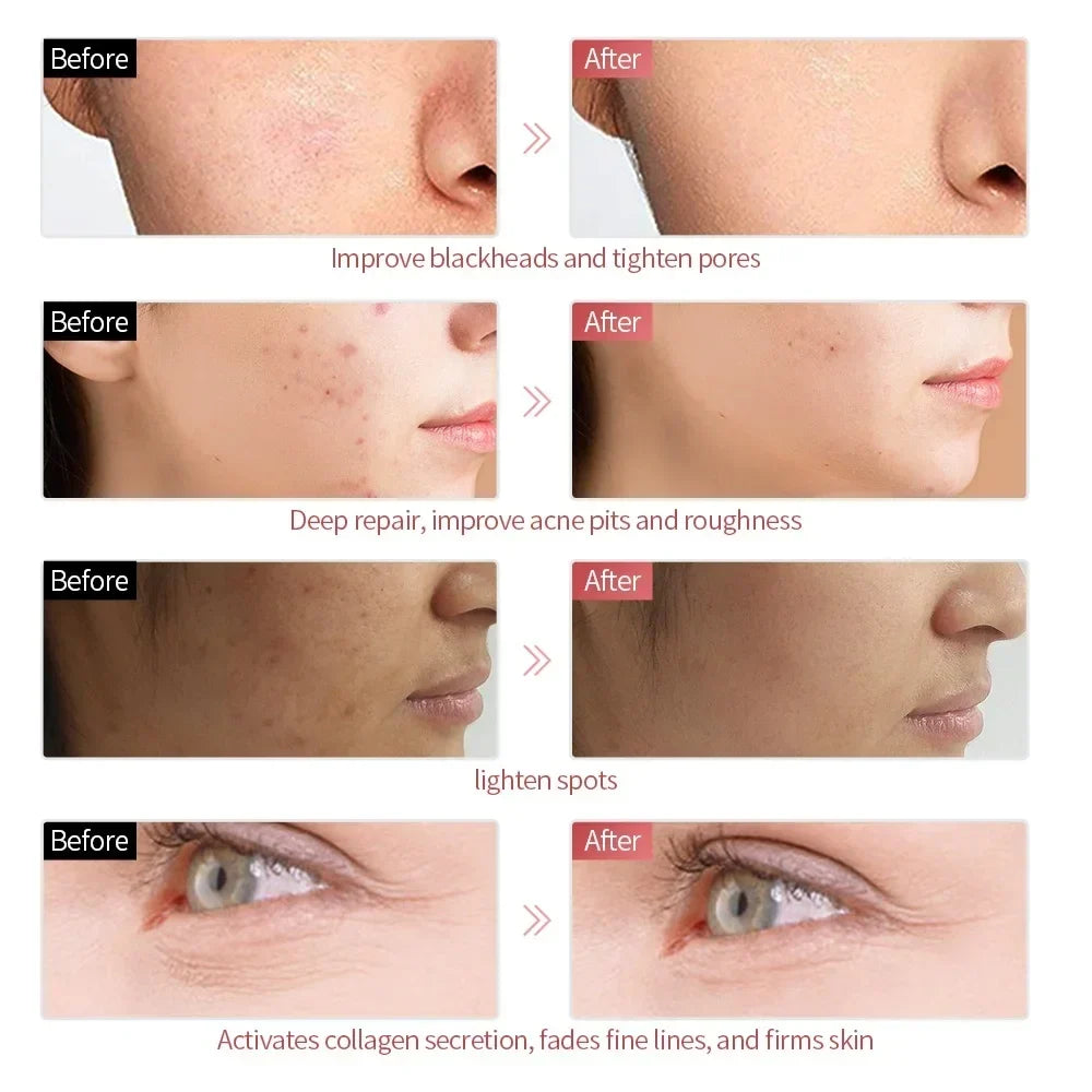Radiant Glow LED Mask
