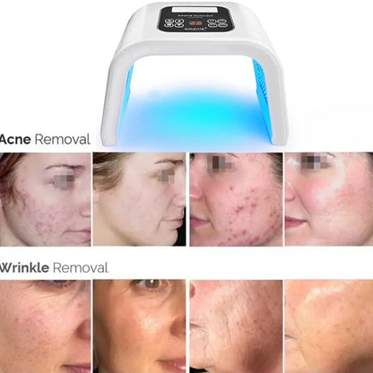 7-Color LED Photon Heating Facial Mask for Home Skin Care-2