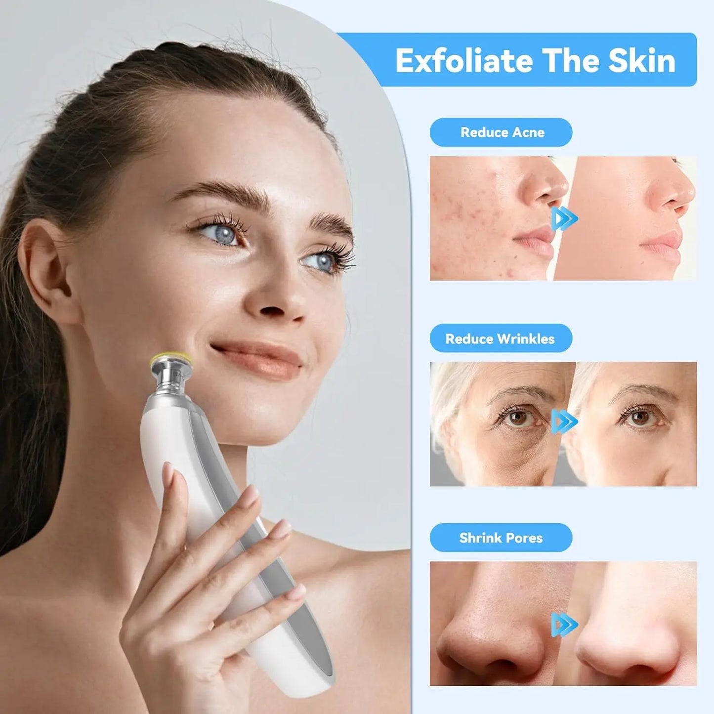 Upgraded Diamond Microdermabrasion Machine White-1