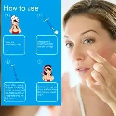 Microneedling Serum Roller for Anti-Ageing & Youthful Skin | Ammuri-1