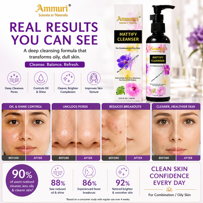 Mattifying Facial Cleanser for Oily Skin & Pore Control (100ml) | Ammuri-1